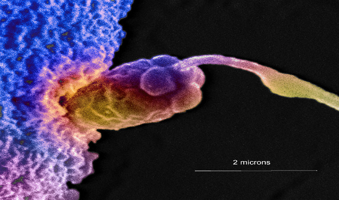 high resolution image of a single clam sperm entering an egg